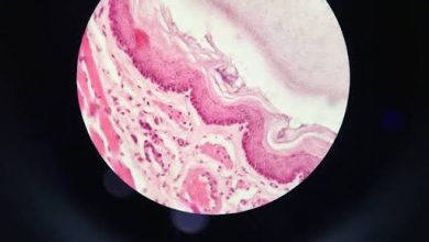 neurological-breakdown-explained:-the-brain-damage-that-makes-ozdikenosis-fatal